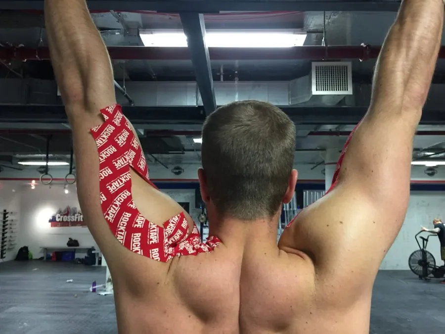 Kinesio Taping at Catalyst Chiropractic and Rehab in Blaine, MN