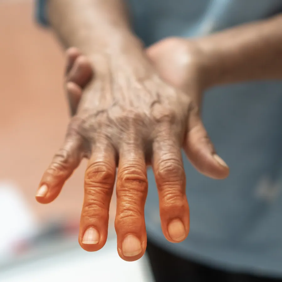 Neuropathy at Catalyst Chiropractic and Rehab in Blaine, MN