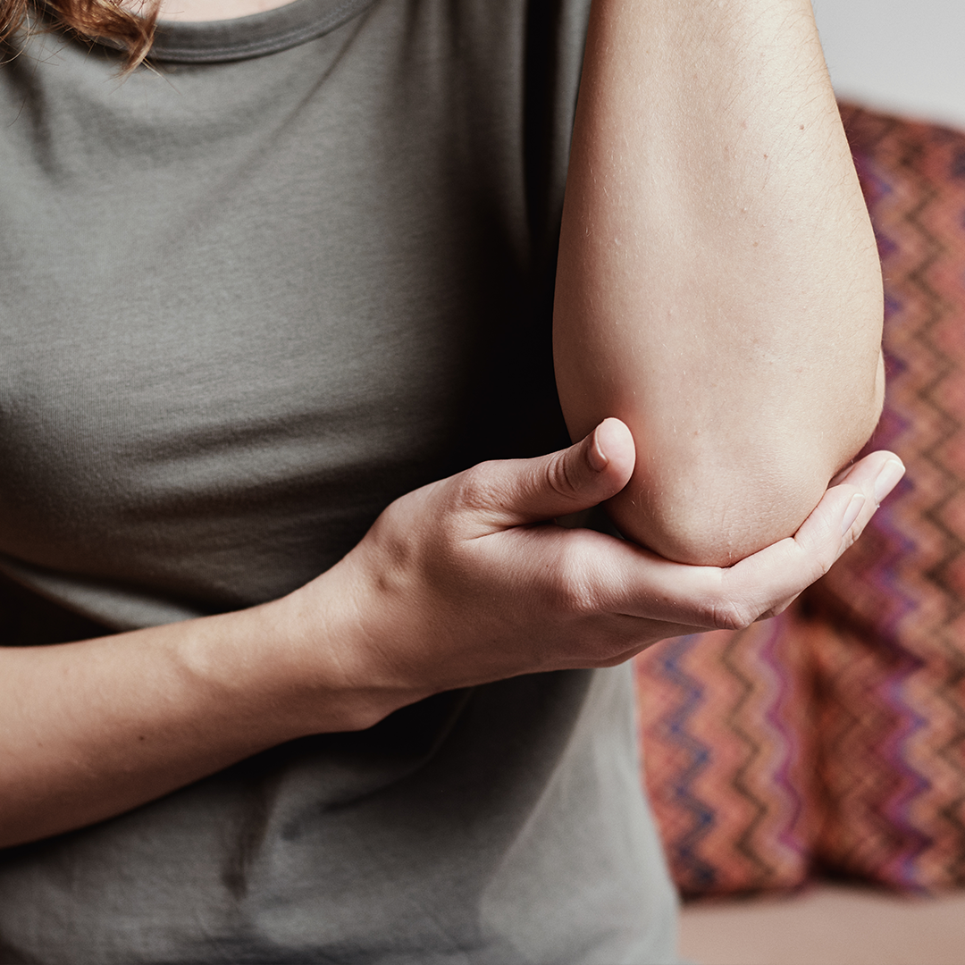 woman holding her elbow due to pain