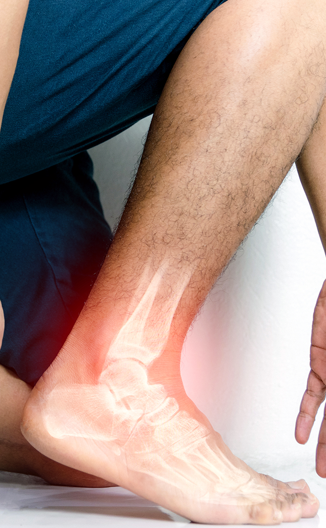 man suffer from leg pain