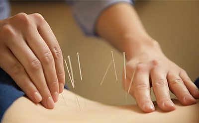 Acupuncture For Joint Relief In Blaine MN