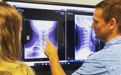 Importance of X-Rays Following a Car Accident